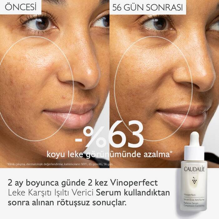 Caudalie Vinoperfect Leke Karşıtı Işıltı Verici Serum 30 ml - 2