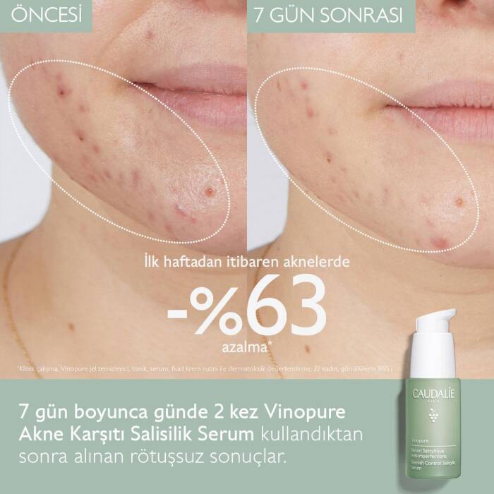 Caudalie Vinopure Akne Karşıtı Salisilik Serum 30 ml - 2