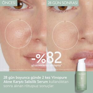 Caudalie Vinopure Akne Karşıtı Salisilik Serum 30 ml - 8