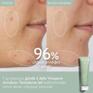 Caudalie Vinopure Arındırıcı Temizleme Jeli 150 ml - 5