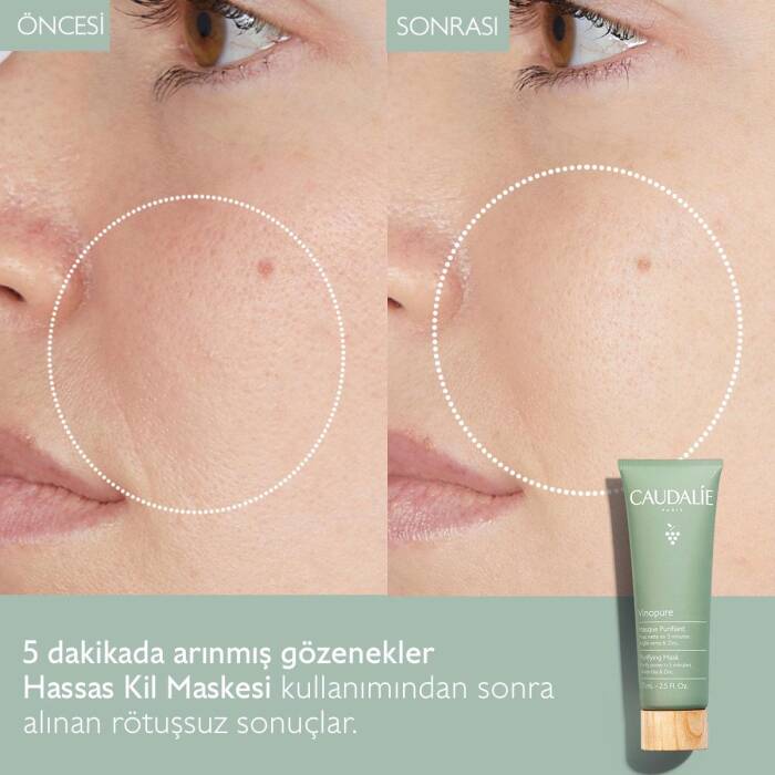 Caudalie Vinopure Hassas Kil Maskesi 75 ml - 2